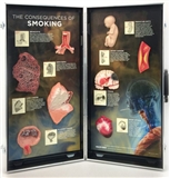 Smoking consequences3D (skutki palenia)